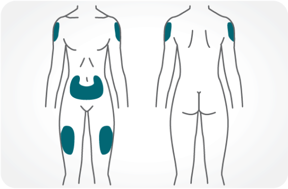 Diagrama del cuerpo dónde colocar la inyección