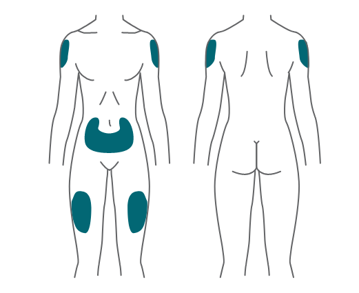 Diagrama del cuerpo dónde colocar la inyección